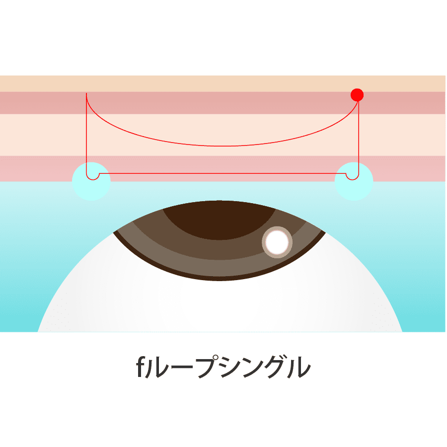 解説イラスト