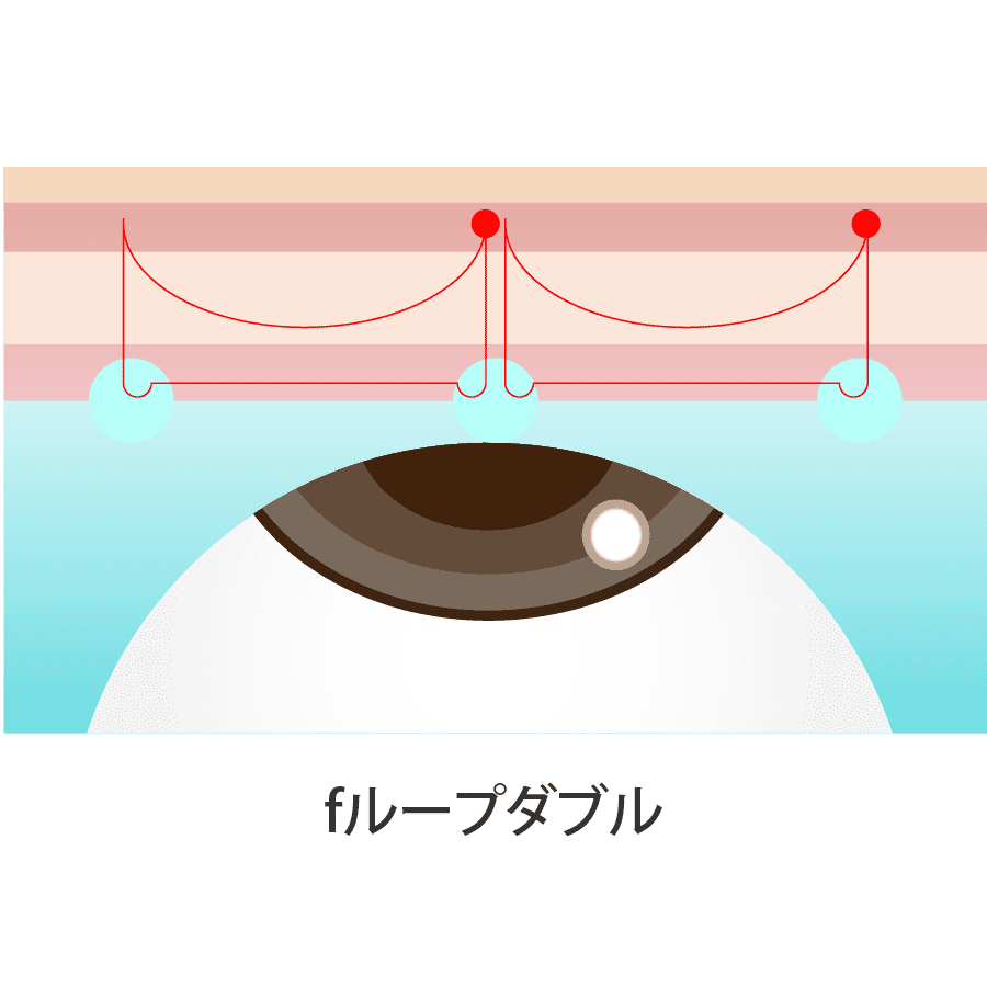解説イラスト