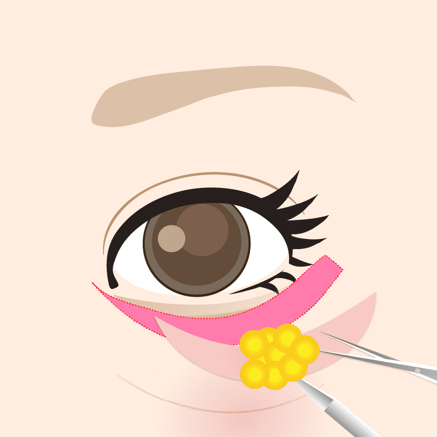 解説イラスト