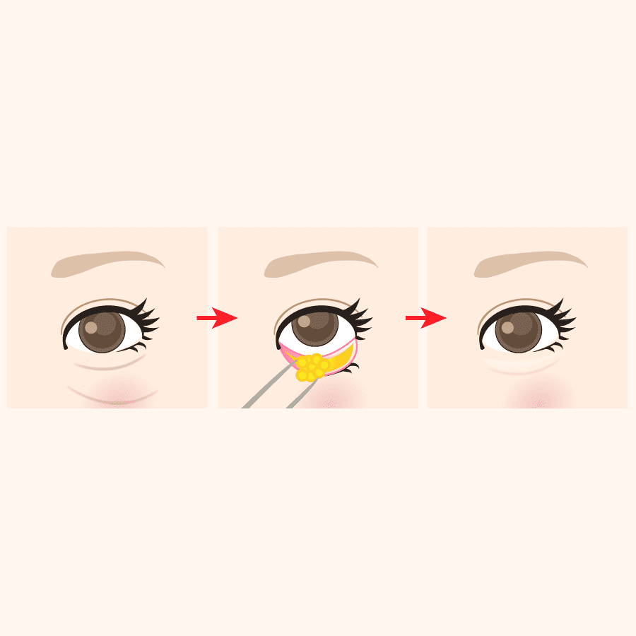 術式のイラスト画像