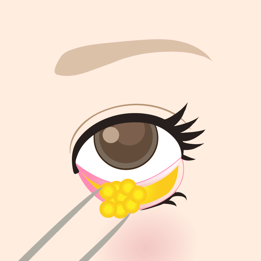 解説イラスト