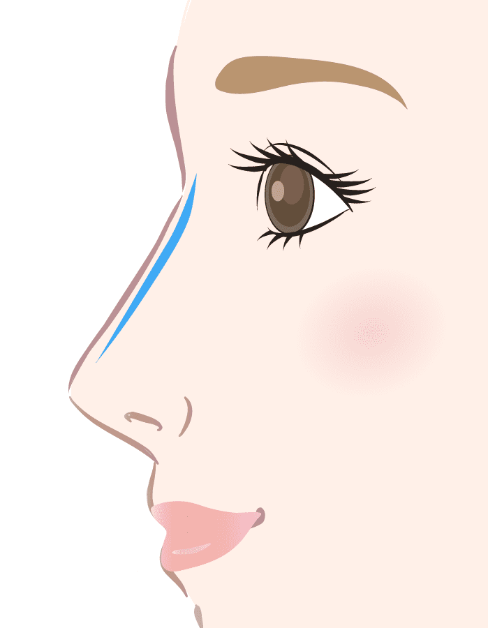 解説イラスト